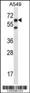 Checkpoint With Forkhead And Ring Finger Domains antibody, 57-729, ProSci, Western Blot image 