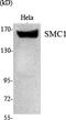 Structural Maintenance Of Chromosomes 1A antibody, A02148-2, Boster Biological Technology, Western Blot image 