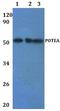 POTE ankyrin domain family member A antibody, A18602-1, Boster Biological Technology, Western Blot image 
