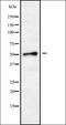 Chromaffin granule amine transporter antibody, orb338175, Biorbyt, Western Blot image 