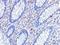 CD82 Molecule antibody, NBP1-76775, Novus Biologicals, Immunohistochemistry frozen image 