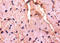Decorin antibody, A52807-100, Epigentek, Immunohistochemistry paraffin image 