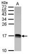 NADH:Ubiquinone Oxidoreductase Subunit B4 antibody, LS-C155314, Lifespan Biosciences, Western Blot image 