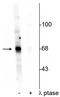 Akt antibody, P00024-1, Boster Biological Technology, Western Blot image 