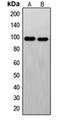 FER Tyrosine Kinase antibody, orb213925, Biorbyt, Western Blot image 