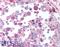 Nibrin antibody, LS-B1494, Lifespan Biosciences, Immunohistochemistry paraffin image 