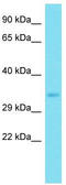 Aquaporin 12A antibody, TA334879, Origene, Western Blot image 