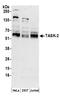 Potassium channel subfamily K member 5 antibody, A304-446A, Bethyl Labs, Western Blot image 