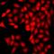 Calcium/Calmodulin Dependent Protein Kinase ID antibody, LS-C668814, Lifespan Biosciences, Immunofluorescence image 