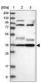Yip1 Domain Family Member 2 antibody, PA5-54112, Invitrogen Antibodies, Western Blot image 