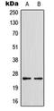 3-oxo-5-alpha-steroid 4-dehydrogenase 1 antibody, orb214608, Biorbyt, Western Blot image 