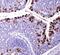 ATP Binding Cassette Subfamily G Member 8 antibody, MA5-24788, Invitrogen Antibodies, Immunohistochemistry paraffin image 