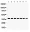 Histone Deacetylase 11 antibody, PA5-79351, Invitrogen Antibodies, Western Blot image 