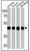 ATPase Na+/K+ Transporting Subunit Beta 1 antibody, GTX22873, GeneTex, Western Blot image 