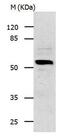 Interleukin 13 Receptor Subunit Alpha 1 antibody, orb107335, Biorbyt, Western Blot image 