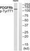 Epidermal growth factor receptor substrate 15 antibody, abx012688, Abbexa, Western Blot image 