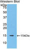Solute Carrier Family 30 Member 8 antibody, LS-C303154, Lifespan Biosciences, Western Blot image 