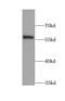 LYN Proto-Oncogene, Src Family Tyrosine Kinase antibody, FNab04903, FineTest, Western Blot image 