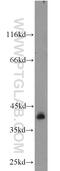 Synaptonemal Complex Central Element Protein 1 antibody, 11063-1-AP, Proteintech Group, Western Blot image 