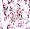 JunB Proto-Oncogene, AP-1 Transcription Factor Subunit antibody, AP0376, ABclonal Technology, Immunohistochemistry paraffin image 