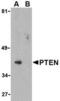 Phosphatidylinositol-3,4,5-trisphosphate 3-phosphatase and dual-specificity protein phosphatase PTEN antibody, TA306223, Origene, Western Blot image 