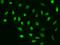 Hypoxia-inducible factor 1-alpha antibody, 200595-T02, Sino Biological, Immunohistochemistry paraffin image 