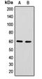 Antagonist Of Mitotic Exit Network 1 Homolog antibody, orb100069, Biorbyt, Western Blot image 