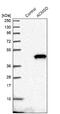 Aminocarboxymuconate Semialdehyde Decarboxylase antibody, NBP1-86480, Novus Biologicals, Western Blot image 