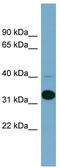 Methionine aminopeptidase 1 antibody, TA333843, Origene, Western Blot image 