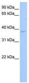 Ribosomal Protein L3 antibody, TA346543, Origene, Western Blot image 