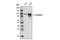 Catenin Beta 1 antibody, 13727S, Cell Signaling Technology, Western Blot image 