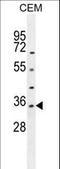 Lactate Dehydrogenase A Like 6A antibody, LS-C165731, Lifespan Biosciences, Western Blot image 
