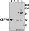 Centrosomal Protein 70 antibody, A10748, Boster Biological Technology, Western Blot image 