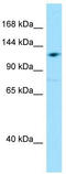 Grid2 Interacting Protein antibody, TA338301, Origene, Western Blot image 