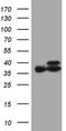 Electron Transfer Flavoprotein Subunit Alpha antibody, NBP2-45542, Novus Biologicals, Western Blot image 