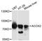 ACOX2 antibody, LS-C747865, Lifespan Biosciences, Western Blot image 