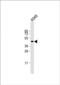 N-Acetyltransferase 16 (Putative) antibody, PA5-49546, Invitrogen Antibodies, Western Blot image 