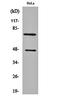 Complement C1s antibody, orb159348, Biorbyt, Western Blot image 