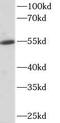 Aldehyde Dehydrogenase 1 Family Member A1 antibody, FNab00284, FineTest, Western Blot image 