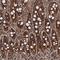 USP6 N-Terminal Like antibody, HPA039196, Atlas Antibodies, Immunohistochemistry paraffin image 
