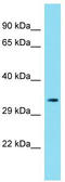 Chromosome 6 Open Reading Frame 136 antibody, TA334818, Origene, Western Blot image 