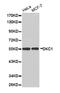 Dyskerin Pseudouridine Synthase 1 antibody, PA5-76036, Invitrogen Antibodies, Western Blot image 