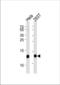 EDB antibody, TA328119, Origene, Western Blot image 