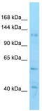 Histone Deacetylase 6 antibody, TA343577, Origene, Western Blot image 