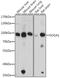 Suppressor Of Glucose, Autophagy Associated 1 antibody, A13046-1, Boster Biological Technology, Western Blot image 