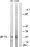 Myogenic Factor 6 antibody, abx013433, Abbexa, Western Blot image 