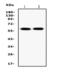 Excitatory amino acid transporter 2 antibody, LS-C357612, Lifespan Biosciences, Western Blot image 
