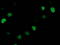 SSX Family Member 1 antibody, TA502730, Origene, Immunofluorescence image 