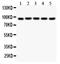 Villin 1 antibody, PB9457, Boster Biological Technology, Western Blot image 