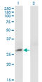 Crystallin Beta B3 antibody, LS-C196975, Lifespan Biosciences, Western Blot image 